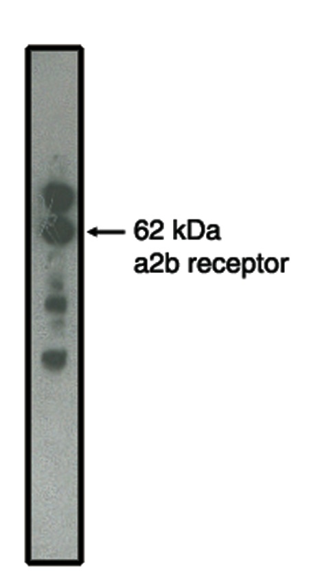 " 
Western blot analysis using alpha2B adrenergic receptor antibody on MDCK cells transfected to produce alpha2B receptor protein."